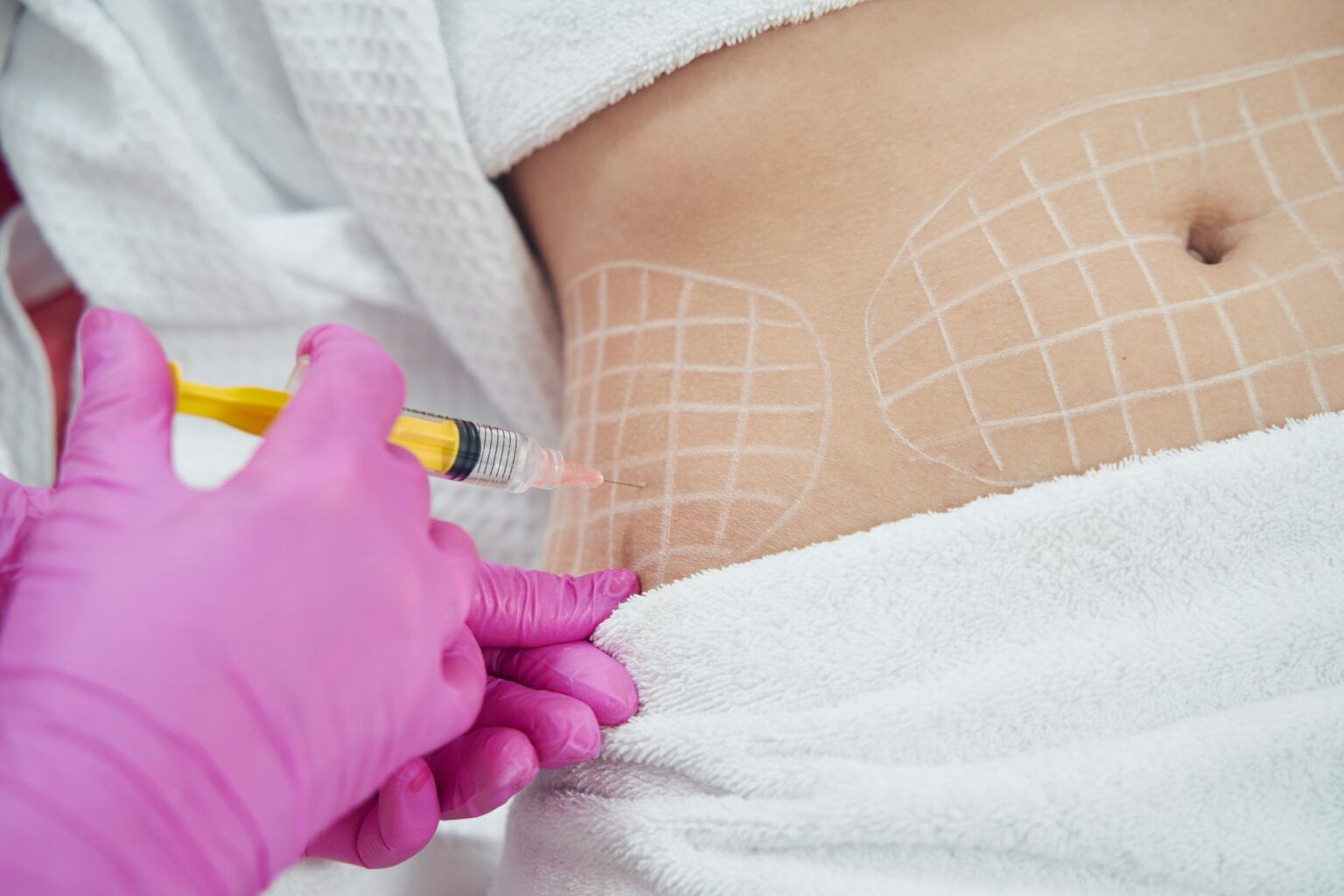 Dermatologist performing non invasive fat reduction procedure in beauty center